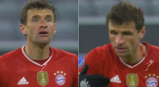 Tại sao Muller bị trọng tài yêu cầu rời sân ngay giữa trận Bayern vs PSG? - Ảnh 1